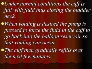 Under normal conditions the cuff is full with fluid thus closing the bladder neck.  When voiding is desired the pump is pressed to force the fluid in the cuff to go back into the balloon reservoir so that voiding can occur.  The cuff then gradually refills over the next few minutes. 
