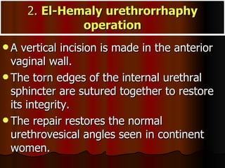 2.  El-Hemaly urethrorrhaphy operation <ul><li>A vertical incision is made in the anterior vaginal wall.  </li></ul><ul><l...