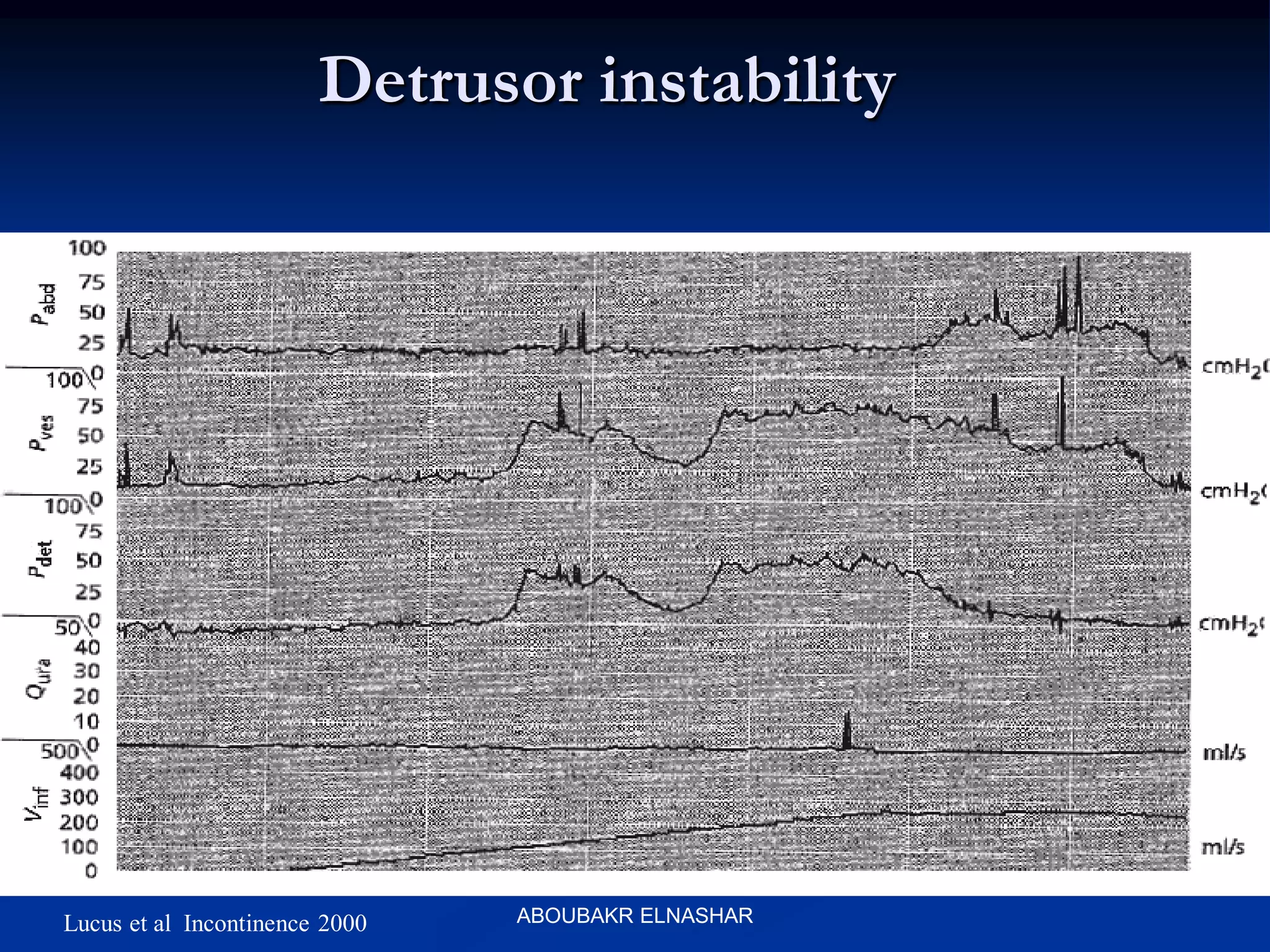 Detrusor instability
Lucus et al Incontinence 2000 ABOUBAKR ELNASHAR
 