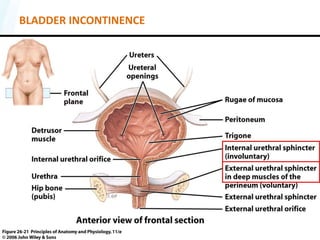 BLADDER INCONTINENCE
 