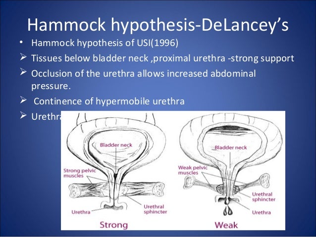 hammock hypothesis