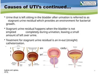 Causes of UTI’s continued…
• Urine that is left sitting in the bladder after urination is referred to as
stagnant urine residual which provides an environment for bacterial
growth.
• Stagnant urine residual happens when the bladder is not
emptied completely during urination, leaving a small
amount of left over urine.
• Treatment for stagnant urine residual is an in-out (straight)
catheterization.
 Catheterization is considered a sterile procedure requiring a
nurse to
perform under a physician’s order.
20
(Lajiness and Lajiness,
2019).
 