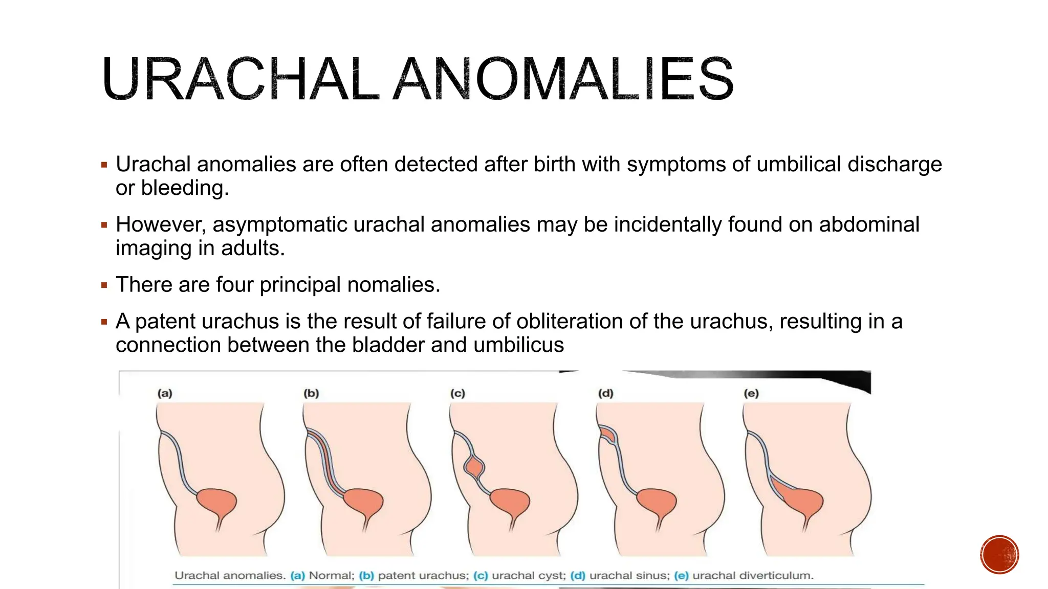 Surgical Anatomy of Urinary bladder.pptx