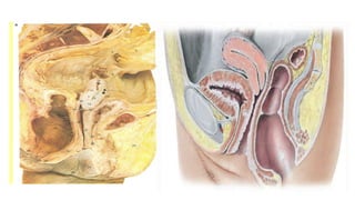 Gross Normal Bladder URINARYBLADDER gross features with relations.pptx