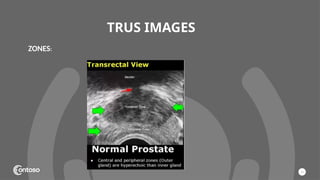 TRUS IMAGES
15
ZONES:
 