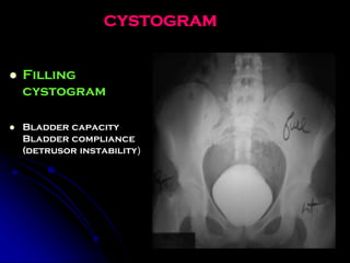 Comprehensive Anatomy and Clinical Insights on the Urinary Bladder | PDF