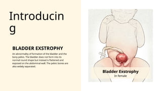 Urinary bladder exstrophy Presentation [Ayushi].pptx