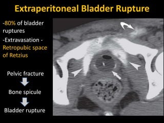 Urinary bladder pathologies | PPTX