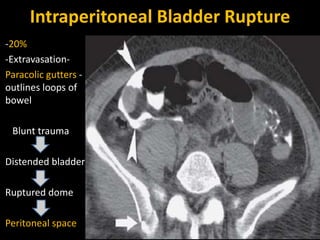 Urinary bladder pathologies | PPTX