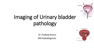 Imaging of Urinary bladder
pathology
Dr. Pradeep Kumar
MD Radiodiagnosis
 