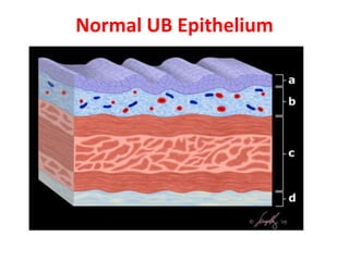 Normal UB Epithelium
 