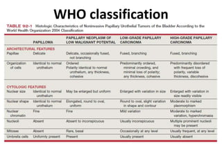 WHO classification
 