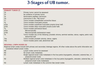3-Stagesof UBtumor.
 