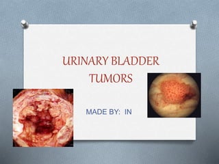 URINARY BLADDER
TUMORS
MADE BY: IN
 