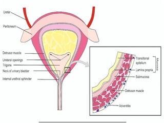 URINARY BLADDER TUMORS .pptx