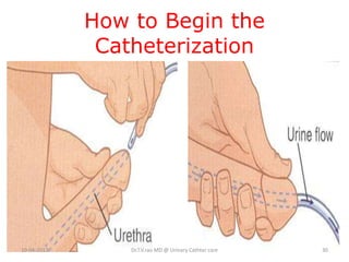 Urinary Catheter Care Principles of Care and Asepsis | PPTX