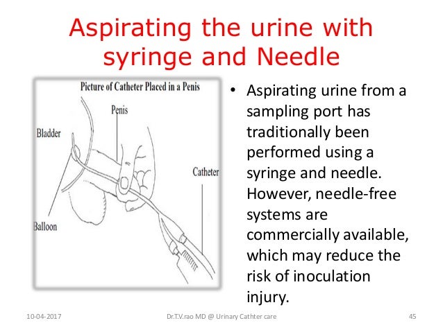 catheter urinary syringe asepsis sampling aspirating