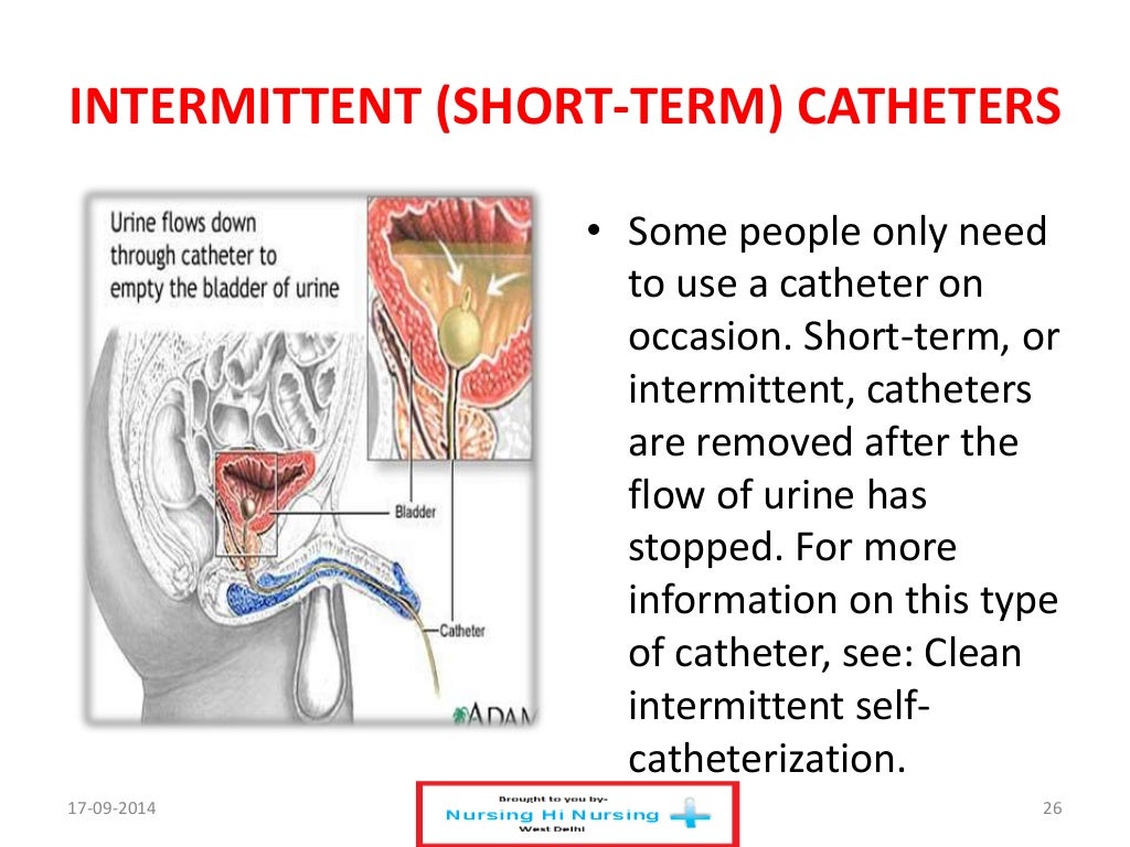 Urinary catheter care skills & asepsis