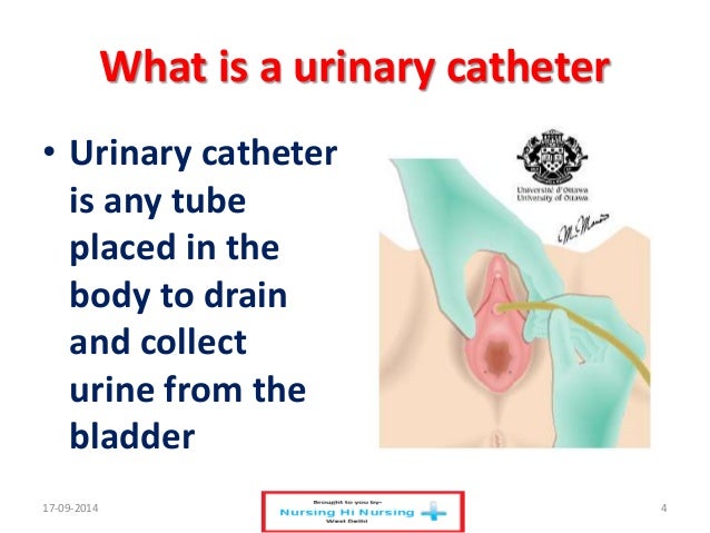 urinary catheterization