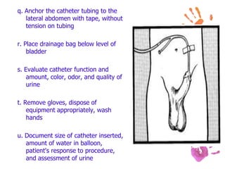 q. Anchor the catheter tubing to the
lateral abdomen with tape, without
tension on tubing
r. Place drainage bag below level of
bladder
s. Evaluate catheter function and
amount, color, odor, and quality of
urine
t. Remove gloves, dispose of
equipment appropriately, wash
hands
u. Document size of catheter inserted,
amount of water in balloon,
patient's response to procedure,
and assessment of urine
 