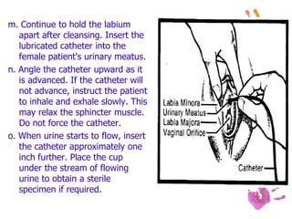 m. Continue to hold the labium
apart after cleansing. Insert the
lubricated catheter into the
female patient's urinary meatus.
n. Angle the catheter upward as it
is advanced. If the catheter will
not advance, instruct the patient
to inhale and exhale slowly. This
may relax the sphincter muscle.
Do not force the catheter.
o. When urine starts to flow, insert
the catheter approximately one
inch further. Place the cup
under the stream of flowing
urine to obtain a sterile
specimen if required.
 