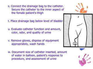 s. Connect the drainage bag to the catheter.
Secure the catheter to the inner aspect of
the female patient's thigh
t. Place drainage bag below level of bladder
u. Evaluate catheter function and amount,
color, odor, and quality of urine
v. Remove gloves, dispose of equipment
appropriately, wash hands
w. Document size of catheter inserted, amount
of water in balloon, patient's response to
procedure, and assessment of urine
 