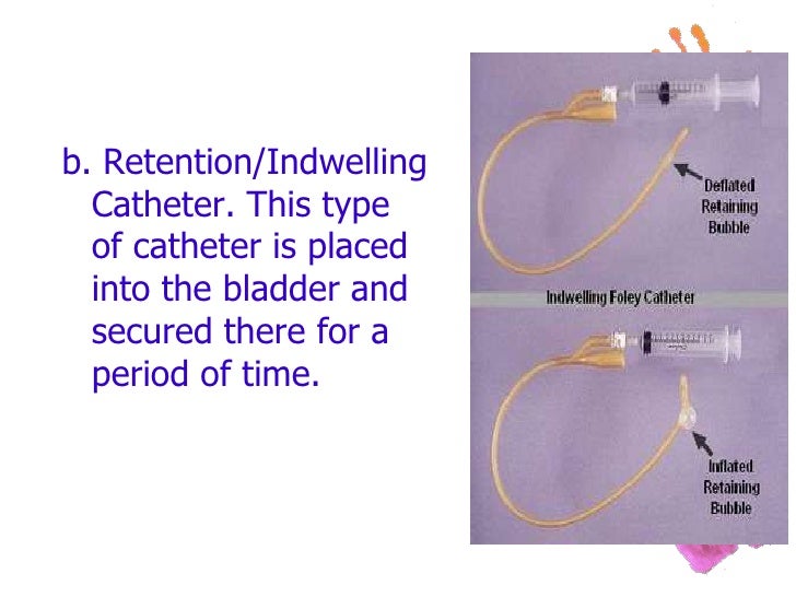 urinary-retention