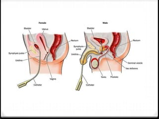 urinarycatheterization-211223113253.pptx