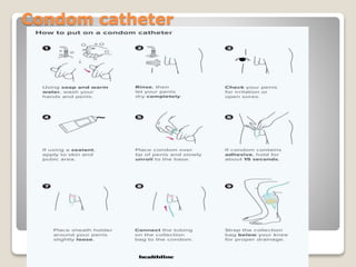 Condom catheter
 