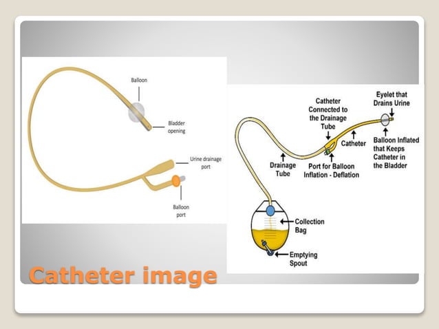 Urinary Catheterization Nursing Procedure & Management ppt.pptx