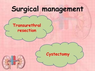 Surgical management
Transurethral
resection
Cystectomy
 