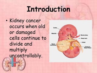 Introduction
• Kidney cancer
occurs when old
or damaged
cells continue to
divide and
multiply
uncontrollably.
 