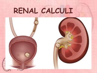 RENAL CALCULI
 