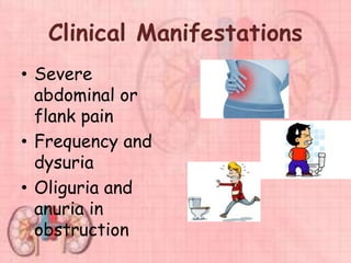 Clinical Manifestations
• Severe
abdominal or
flank pain
• Frequency and
dysuria
• Oliguria and
anuria in
obstruction
 