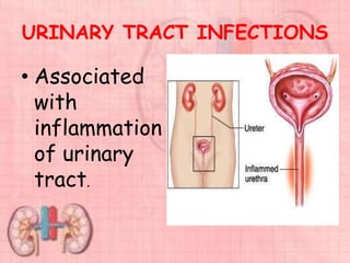 URINARY TRACT INFECTIONS
• Associated
with
inflammation
of urinary
tract.
 