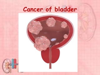 Cancer of bladder
 