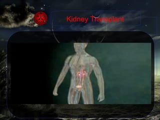 Kidney transplantation is replacement of nonworking kidneys with a healthy kidney from another person (the donor). The healthy kidney (the "graft") takes over the functions of nonworking kidneys. Kidney Transplant 