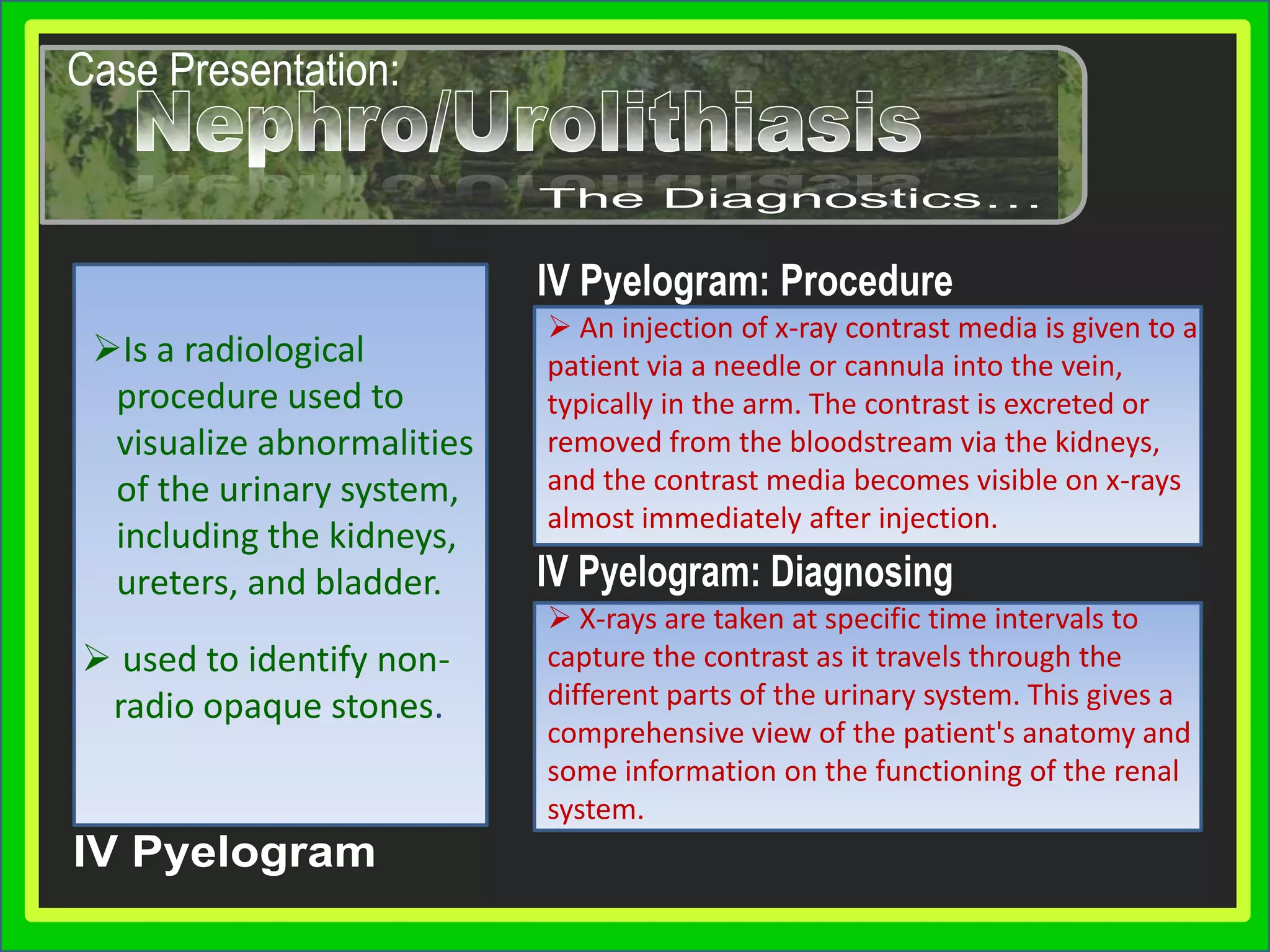 StruviteCase Presentation:Nephro/UrolithiasisNephro/UrolithiasisDetermining EtiologyKey points:Key points:A number of different medical conditions can lead to an increased risk for developing kidney stones:» Loading…» »  Loading…» » »  Loading…» » » »  Loading…» » » » » Loading…