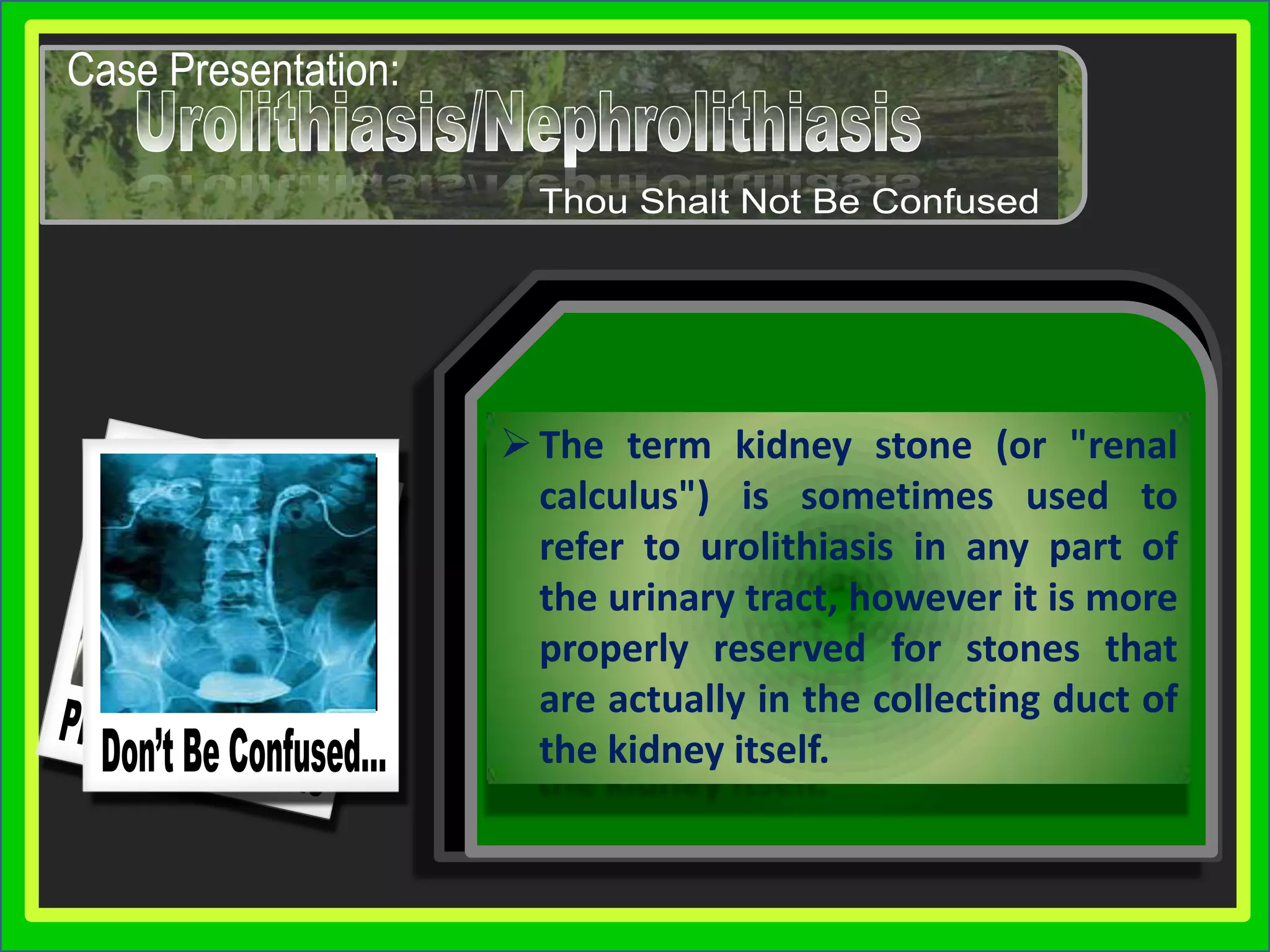 Feed Your Mind…Presentation SkillsCase Presentation:NephrolithiasisUrolithiasisIntroduction of the Diseaseis the condition where urinary calculi are formed in the kidney