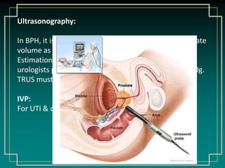 Nocturia, dysuria, hematuria, Sitting to void 