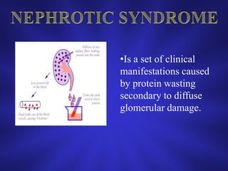 Uroflowmetry: At a volume of 125-150ml, normal individuals have average flow rates of 12ml/sec & peak flow close to 20ml/sec.Mild 11-15 ml/sec    Moderate  7 and  10 ml/sec    Severe  7ml/sec