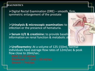  May report:Decreased force/caliber of urinary stream; dribbling