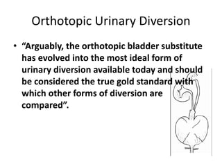 Orthotopic Urinary Diversion 
• “Arguably, the orthotopic bladder substitute 
has evolved into the most ideal form of 
urinary diversion available today and should 
be considered the true gold standard with 
which other forms of diversion are 
compared”. 
 