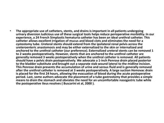 • The appropriate use of catheters, stents, and drains is important in all patients undergoing 
urinary diversion Judicious use of these surgical tools helps reduce perioperative morbidity. In our 
experience, a 24 French Simplastic hematuria catheter has been an ideal urethral catheter. This 
catheter allows excellent irrigation of mucus and blood clots and eliminates the need for a 
cystostomy tube. Ureteral stents should extend from the ipsilateral renal pelvis across the 
ureteroenteric anastomosis and may be either externalized to the skin or internalized and 
anchored to the urethral catheter (our preference). Externalized ureteral stents can be removed 1 
to 2 weeks postoperatively. However, stents that are anchored to the urethral catheter are 
generally removed 3 weeks postoperatively when the urethral catheter is removed. All patients 
should have a pelvic drain postoperatively. We advocate a 1-inch Penrose drain placed posterior 
to the bladder substitute and brought out a separate stab wound lateral to the midline incision. 
This Penrose drain prevents the accumulation of urine and serous fluid and is generally removed 
after the urethral catheter is removed at 3 weeks postoperatively. A large suction Hemovac drain 
is placed for the first 24 hours, allowing the evacuation of blood during the acute postoperative 
period. Last, some authors advocate the placement of a tube gastrostomy that provides a simple 
means to drain the stomach and obviates the need for an uncomfortable nasogastric tube while 
the postoperative ileus resolves ( Buscarini et al, 2000 ). 
 