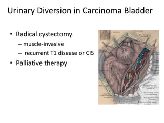 Urinary Diversion in Carcinoma Bladder 
• Radical cystectomy 
– muscle-invasive 
– recurrent T1 disease or CIS 
• Palliative therapy 
 