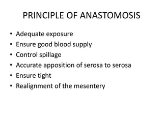 PRINCIPLE OF ANASTOMOSIS
• Adequate exposure
• Ensure good blood supply
• Control spillage
• Accurate apposition of serosa to serosa
• Ensure tight
• Realignment of the mesentery
 