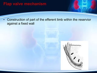Flap valve mechanism
• Construction of part of the efferent limb within the reservior
against a fixed wall
 