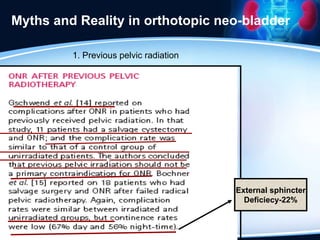 Myths and Reality in orthotopic neo-bladder
1. Previous pelvic radiation
External sphincter
Deficiecy-22%
 