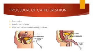 PROCEDURE OF CATHETERIZATION
 Preparation
 Insertion of catheter
 After are and removal of urinary catheter
 