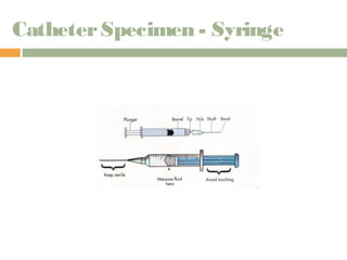 Catheter Specimen - Syringe 
 